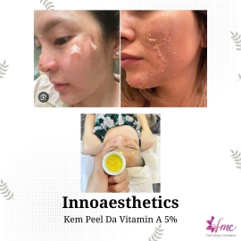 INNOAESTHETICS LIGHTENING PEEL VITAMIN A 5%